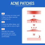 Acne Patch Gentle Facial Care