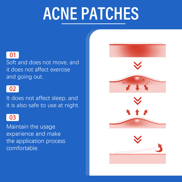 Acne Patch Gentle Facial Care